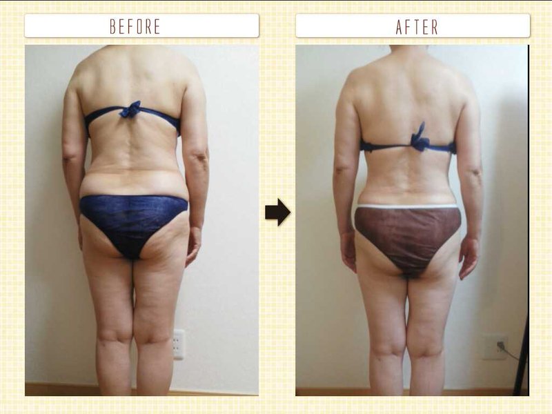 ブライダルシェービング&整顔矯正サロンStrawberryCandle | 目黒のエステサロン ブライダルシェービング&整顔矯正サロンStrawberryCandle | 目黒のエステサロン