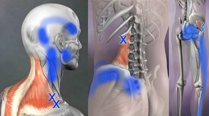 加圧ボディメイキングサロン　アプレ | 日吉のリラクゼーション