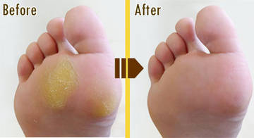 足のトータルケアサロン フットアドバンス辻堂店 | 藤沢のリラクゼーション 足のトータルケアサロン フットアドバンス辻堂店 | 藤沢のリラクゼーション