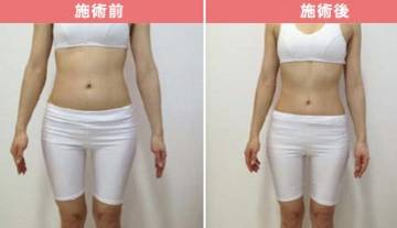 エステハウスｅｌｌｅｓ　日高店 | 飯能のエステサロン