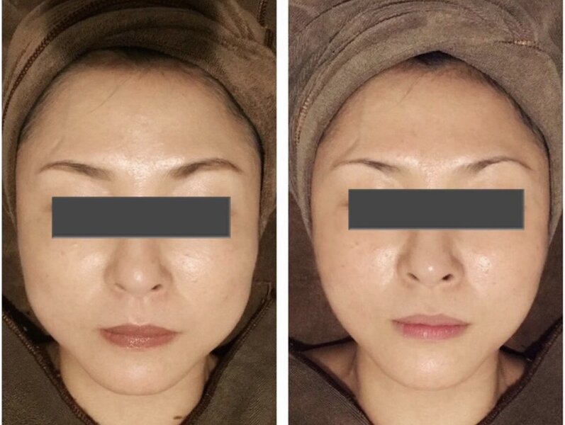 フェイシャル＆ボディトリートメント専門店SalonLena | 柏のエステサロン