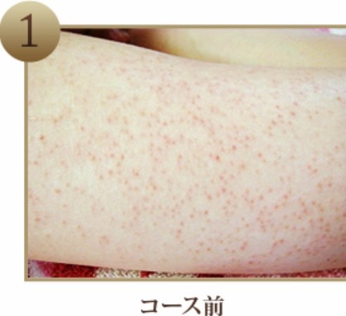 エステティック 美久 | 白石区/南区/豊平区周辺のエステサロン