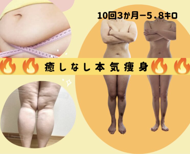 フレクシー | 新宿のエステサロン