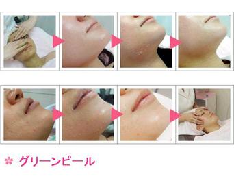 ビューティーメイクさくら | 西葛西のエステサロン ビューティーメイクさくら | 西葛西のエステサロン