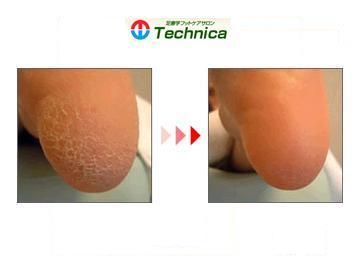 八王子フットケアサロン 　テクニカ | 八王子のリラクゼーション