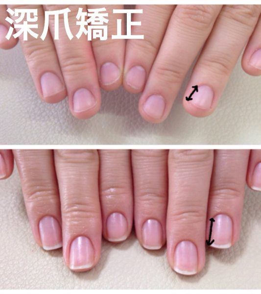 I ☆ NAIL - アイネイル - | 河内長野のネイルサロン I ☆ NAIL - アイネイル - | 河内長野のネイルサロン