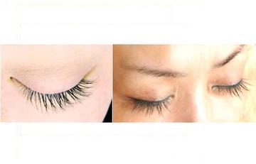 テクニカルエステ INCANTO | 豊中のエステサロン