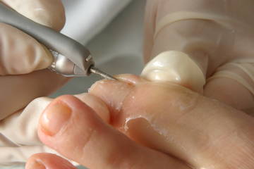 ドイツ式メディカルフットケアサロン　フットラボ | 梅田のエステサロン