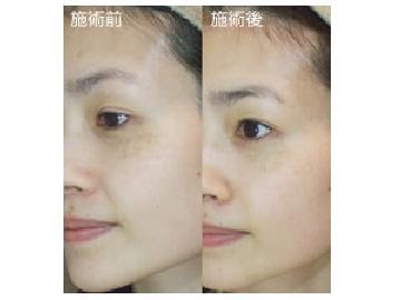 Kaoya plus ~エステサロン~ | 三宮のエステサロン Kaoya plus ~エステサロン~ | 三宮のエステサロン