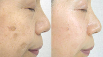 Esthetic 火水呼 エステティック・ヒミコ 神戸店 | 元町のエステサロン Esthetic 火水呼 エステティック・ヒミコ 神戸店 | 元町のエステサロン