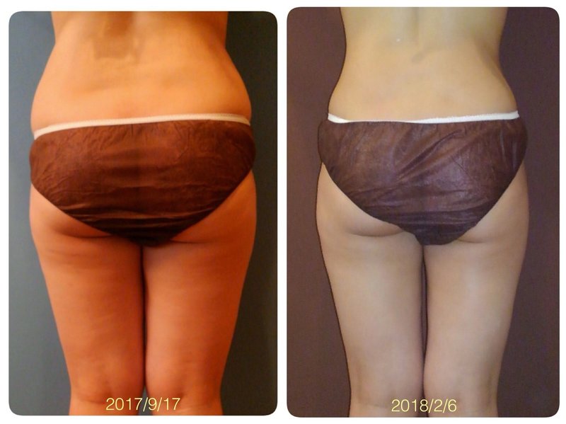 Grace Salon | 岩国のエステサロン Grace Salon | 岩国のエステサロン