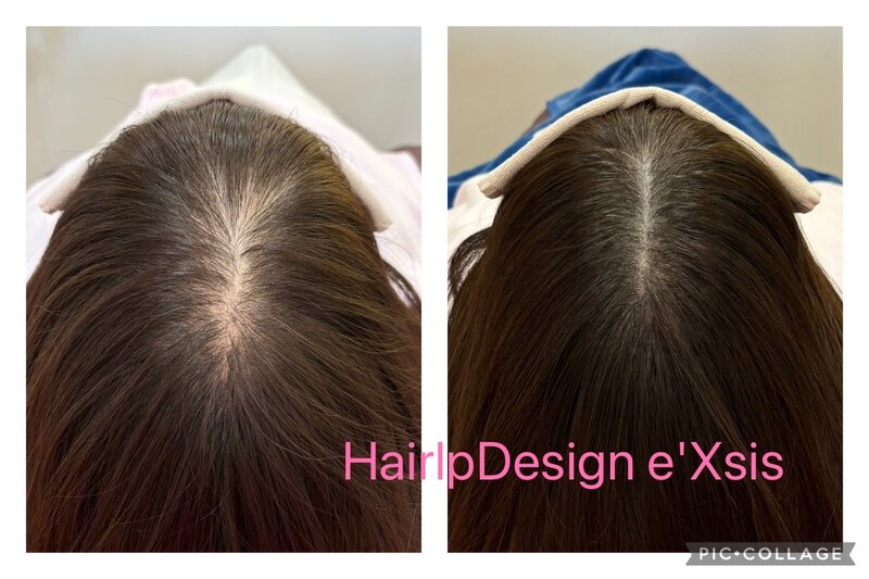 エクシス 富山店 ～エステサロン～ | 富山のエステサロン