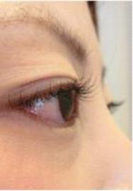 ビューティークリニックＭＯＲＩ - アイラッシュ - | 倉敷のアイラッシュ