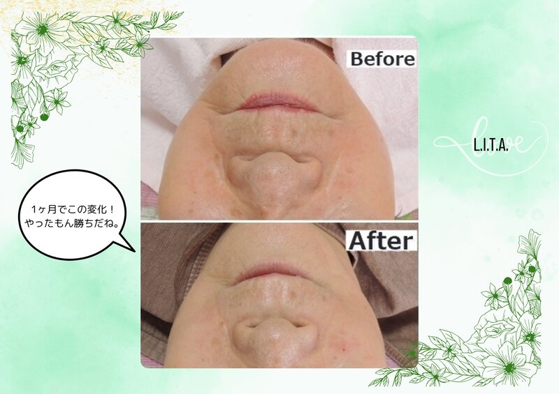 L.I.T.A.(旧マインドテラピ) | 豊橋のエステサロン L.I.T.A.(旧マインドテラピ) | 豊橋のエステサロン