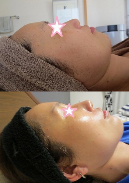 Facial salon　SHION　～心温～ | 静岡のエステサロン