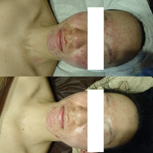 Facial salon　SHION　～心温～ | 静岡のエステサロン