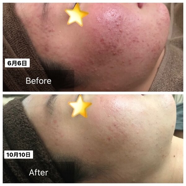 デターントゥ | 栄/矢場町のエステサロン デターントゥ | 栄/矢場町のエステサロン