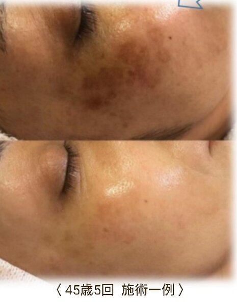 エステティック・ネイル 実南樹～エステ～ | 柏のエステサロン