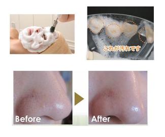 MIN 幸店 | 浜松のエステサロン