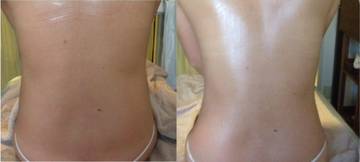 インディバ・デトックス専門店 Erp | 元町のエステサロン インディバ・デトックス専門店 Erp | 元町のエステサロン