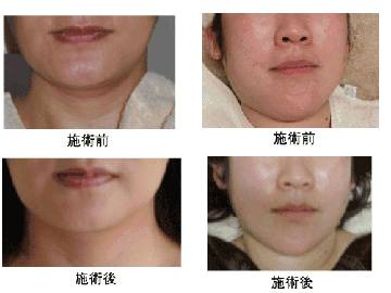 自然派エステティックサロン アングレイス | 宇都宮のエステサロン