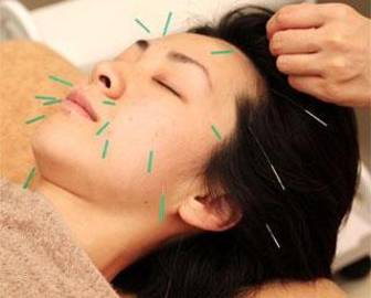 プラーカ鍼灸室 整顔・ボディケアサロンwellciesta | 新潟のリラクゼーション プラーカ鍼灸室 整顔・ボディケアサロンwellciesta | 新潟のリラクゼーション