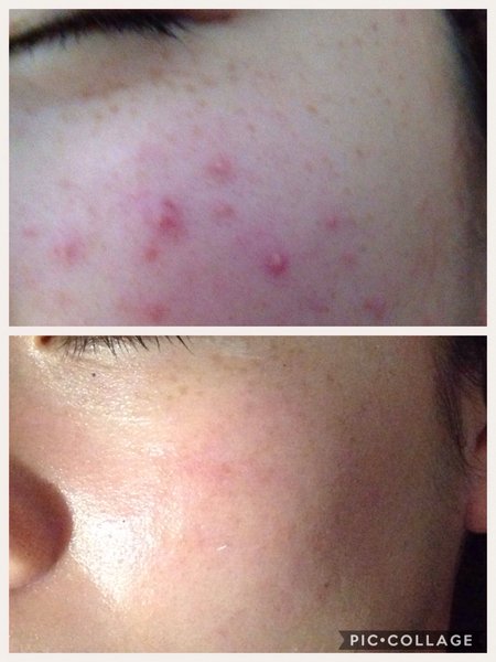 トータルエステサロンラ・ティアラ | 岩出のエステサロン トータルエステサロンラ・ティアラ | 岩出のエステサロン