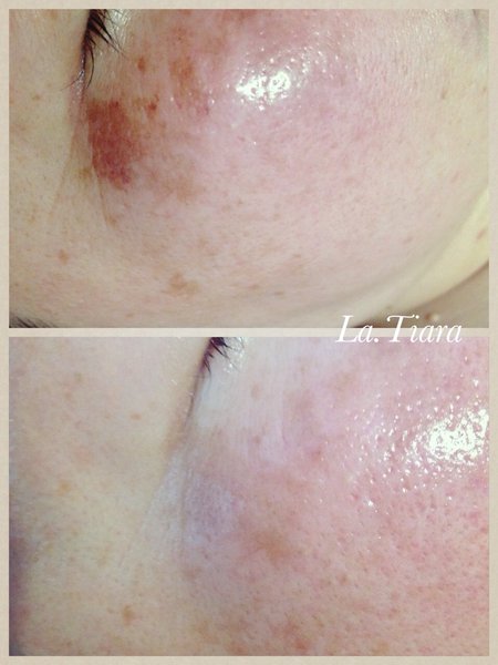 トータルエステサロンラ・ティアラ | 岩出のエステサロン トータルエステサロンラ・ティアラ | 岩出のエステサロン