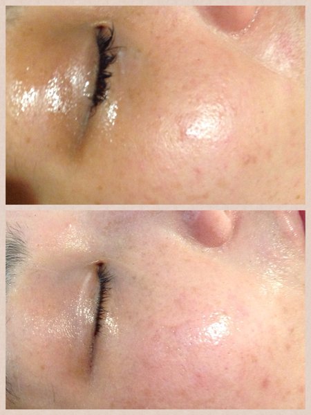 トータルエステサロンラ・ティアラ | 岩出のエステサロン トータルエステサロンラ・ティアラ | 岩出のエステサロン