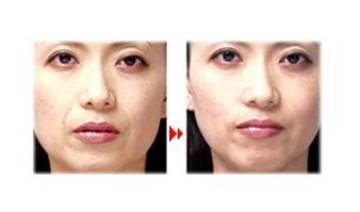 ＲＩＫＡＣＯ | 和歌山のエステサロン