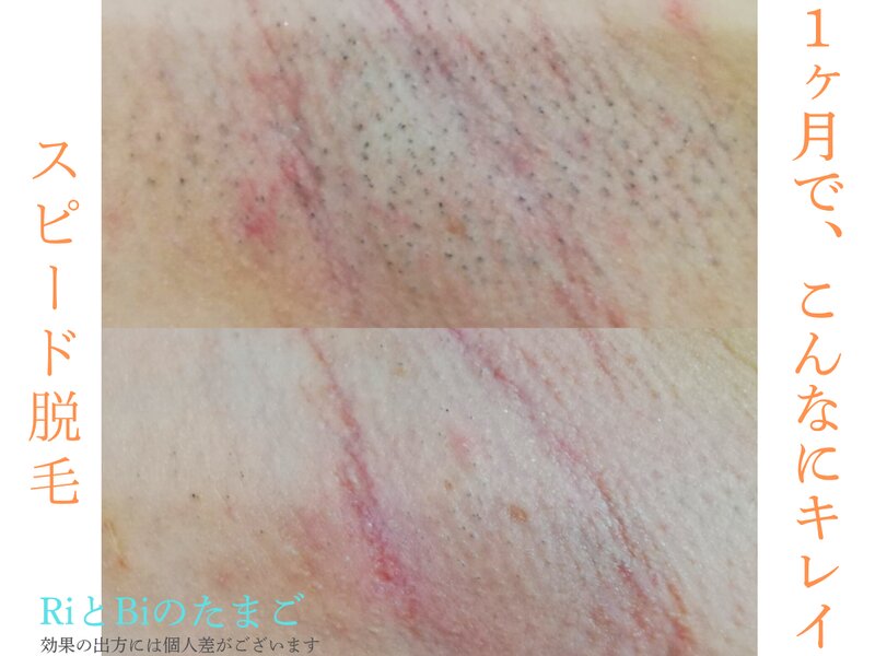 RiとBiのたまご（りとびのたまご） | 弘前のエステサロン