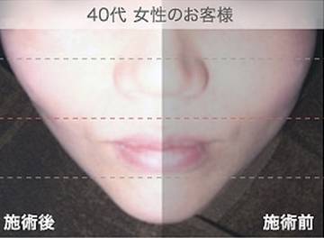 Face Line Fleur | 山科のエステサロン