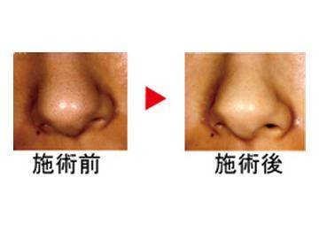 美ｄｅクリニカル | 巣鴨のエステサロン