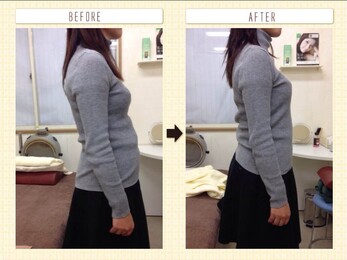 西宮市鳴尾　まつおか鍼灸整体院