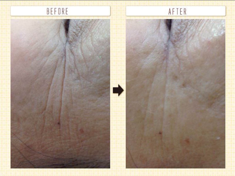 西宮市鳴尾　まつおか鍼灸整体院 | 西宮のリラクゼーション