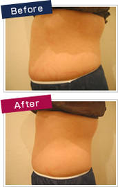 KyaraBeauty 伽羅ビューティー | 明石のエステサロン