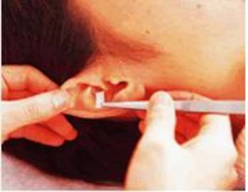 ビューティースリムreborn　銀座店 | 銀座のエステサロン