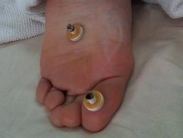 いちかわレディース鍼灸サロン | 梅田のエステサロン いちかわレディース鍼灸サロン | 梅田のエステサロン