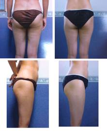 ダイエット・痩身・美顔・マツエクのエステサロン　ASHUR真美ヶ丘店 | 香芝のエステサロン