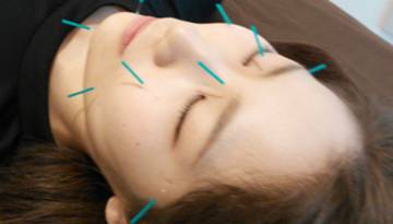 フルケア鍼灸整骨院 | 多摩のリラクゼーション