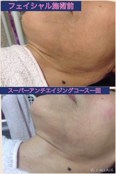 平塚エステ、ネイルサロンTiara Forever Princess | 平塚のネイルサロン