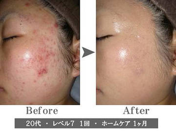 プライベートサロンＯｌｕｏｌｕ | 八千代のエステサロン