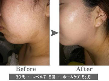 プライベートサロンＯｌｕｏｌｕ | 八千代のエステサロン