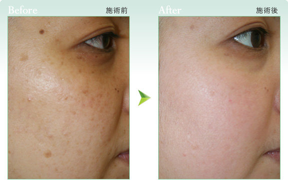 ＪＥＲＲＹ＆ＭＩＵ | 足利のアイラッシュ