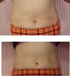 横浜市緑区キャビテーションコースもあるデイジー整体院 | 青葉台のエステサロン 横浜市緑区キャビテーションコースもあるデイジー整体院 | 青葉台のエステサロン