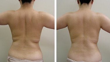 エステサロン  ラ・メール | 佐久のエステサロン