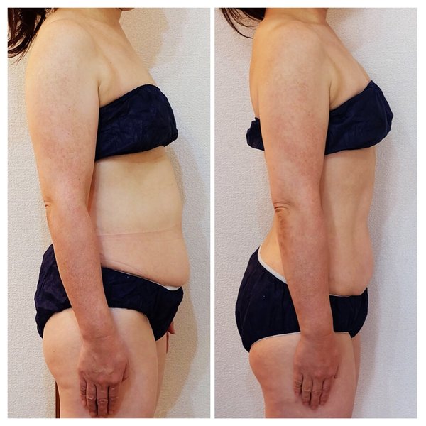 Ra-cuu ラクゥー | 芦屋のエステサロン