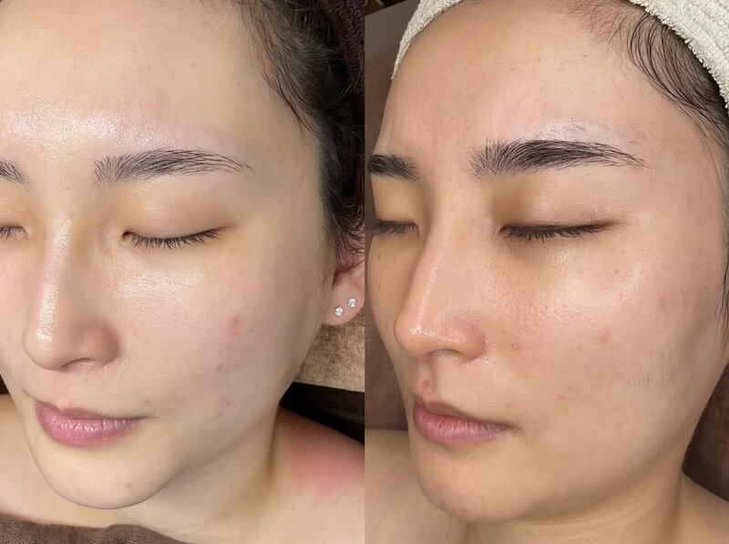 スマイルサロン | 吉祥寺のエステサロン