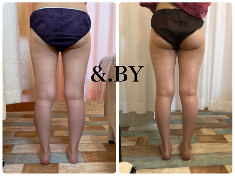 TOTAL BEAUTY SALON &.BY 〜アンドバイ〜 | 羽島のエステサロン