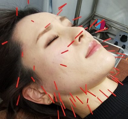 きらめき鍼灸治療院 | 天神/大名のリラクゼーション